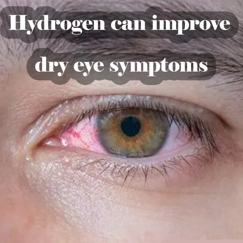 [Forwarding]Hydrogen gas can improve the symptoms of dry eye disease